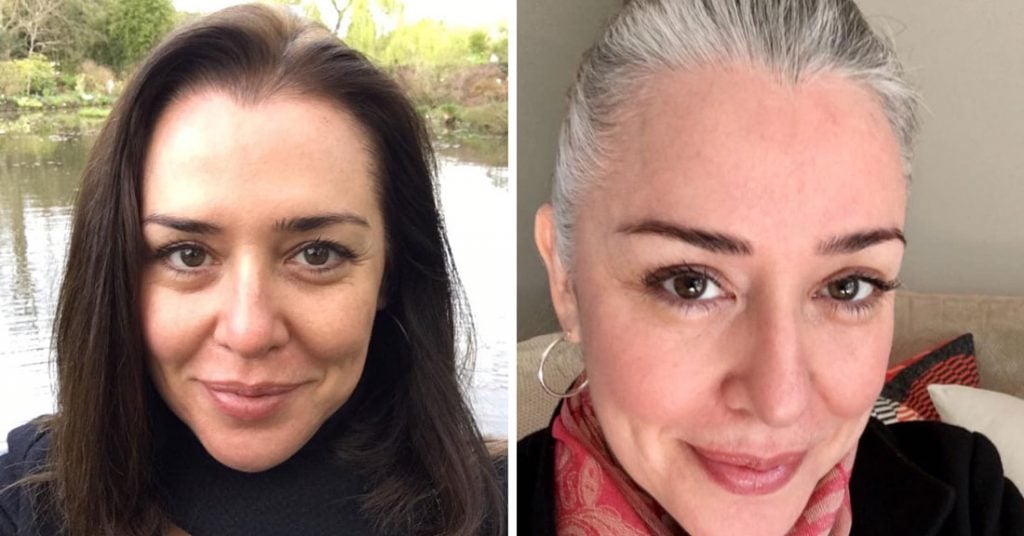 30 Gray Hair Before And After Pix That Will Blow Your Mind 