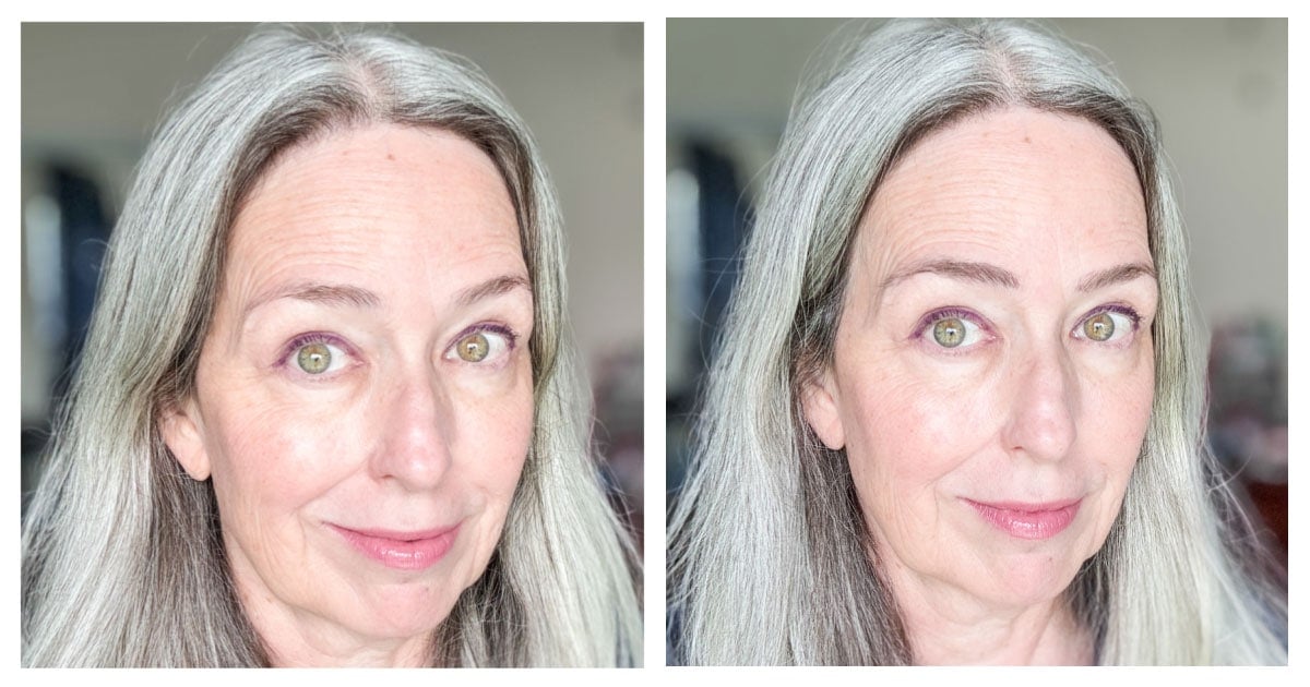image of katie before and after using micro tip in Flora