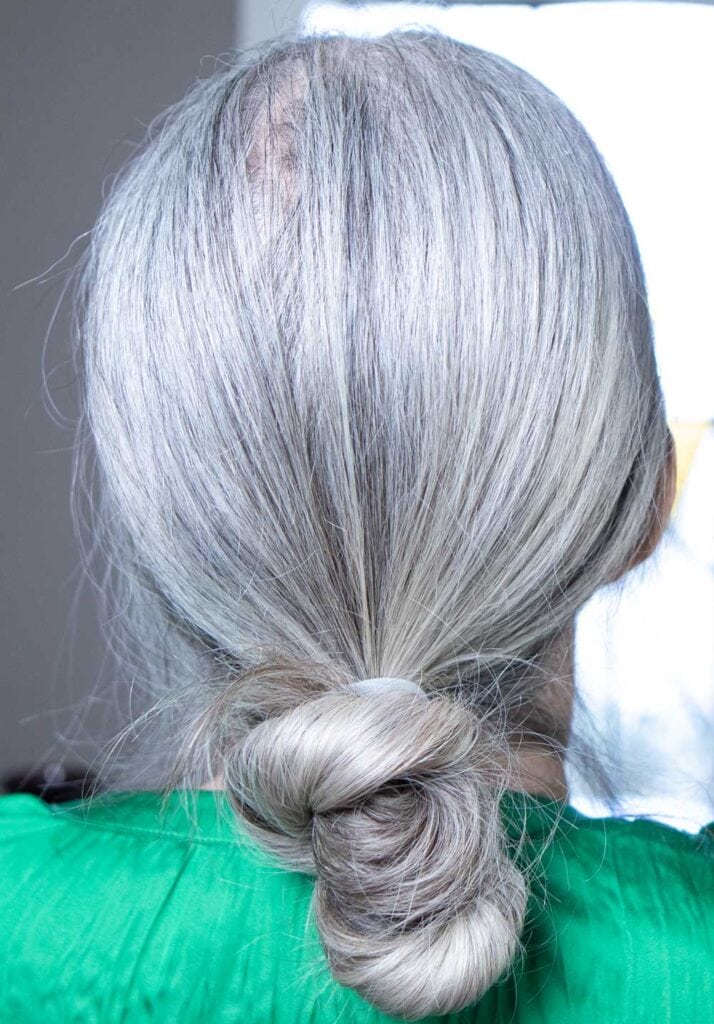 image of the back of a gray-haired woman's head , exposing a bald spot