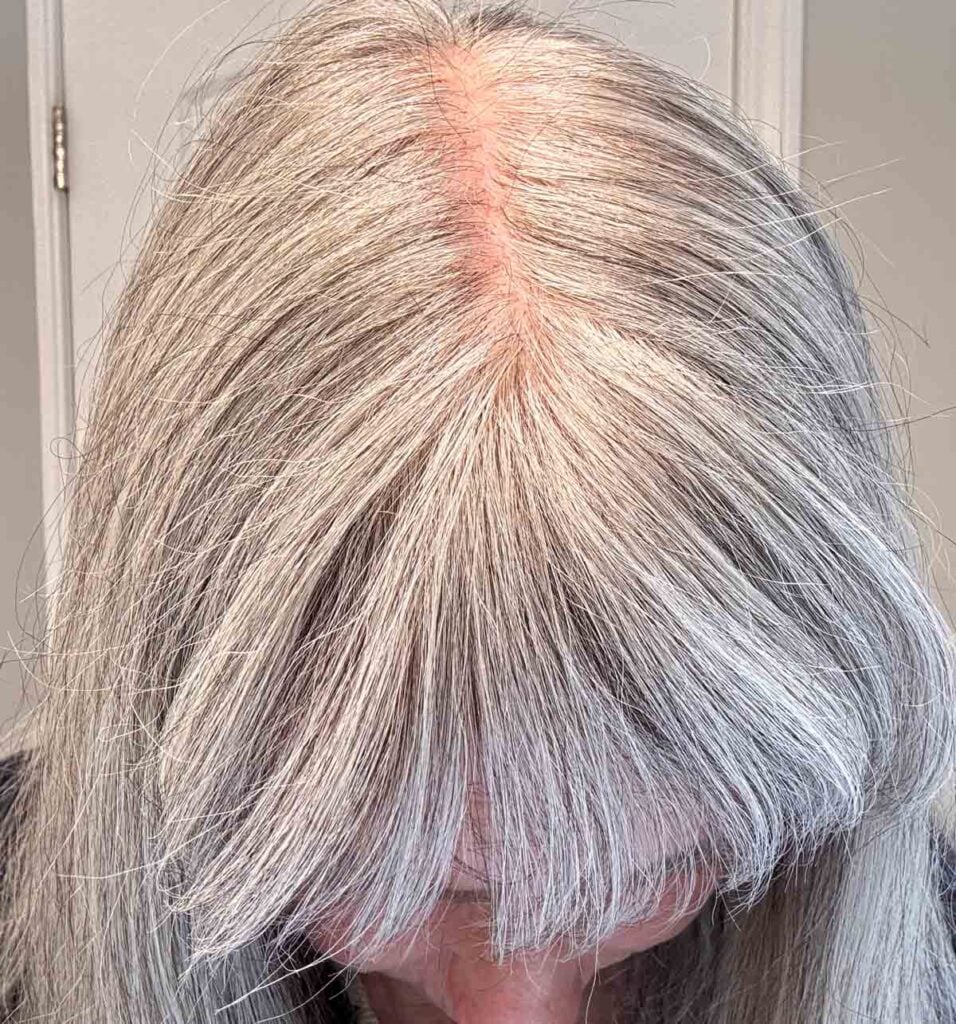 image of katie's scalp before using Border Line White on her gray hair