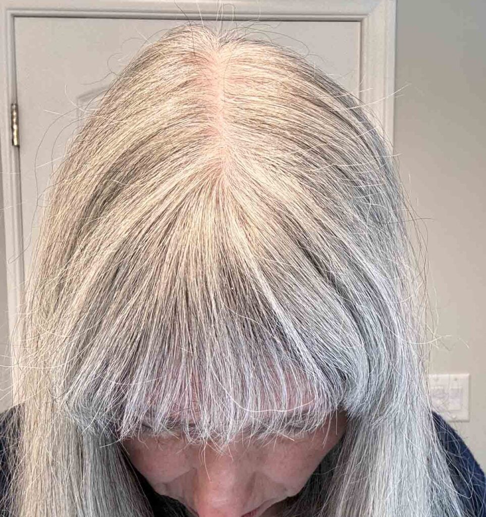 image of katie's scalp after using white border line powder